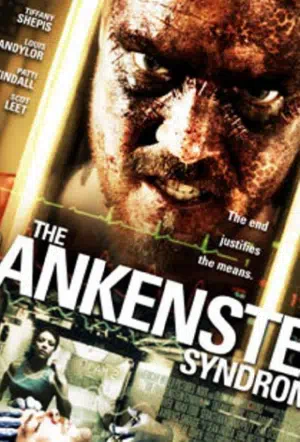 Синдром Франкенштейна смотреть онлайн в HD 1080